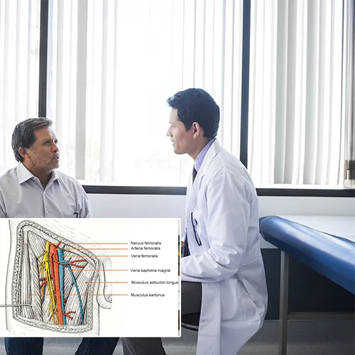 Understanding the Ins and Outs of Penile Implant Surgery at  Urological Consultants of Florida 
