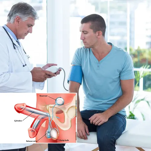 Welcome to  Urological Consultants of Florida 
: Navigating Penile Implant Surgery with Expert Guidance