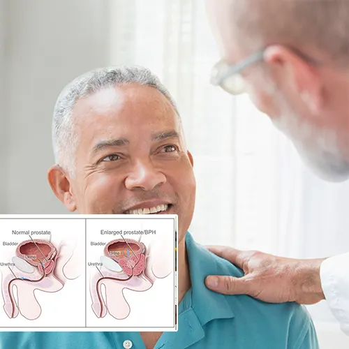 Understanding the Lifelong Benefits of Penile Implant Surgery at  Urological Consultants of Florida 
