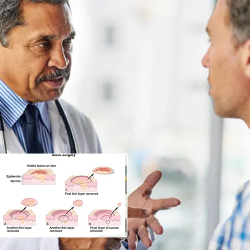 Why Choose  Urological Consultants of Florida 
for Your Penile Implant Surgery?
